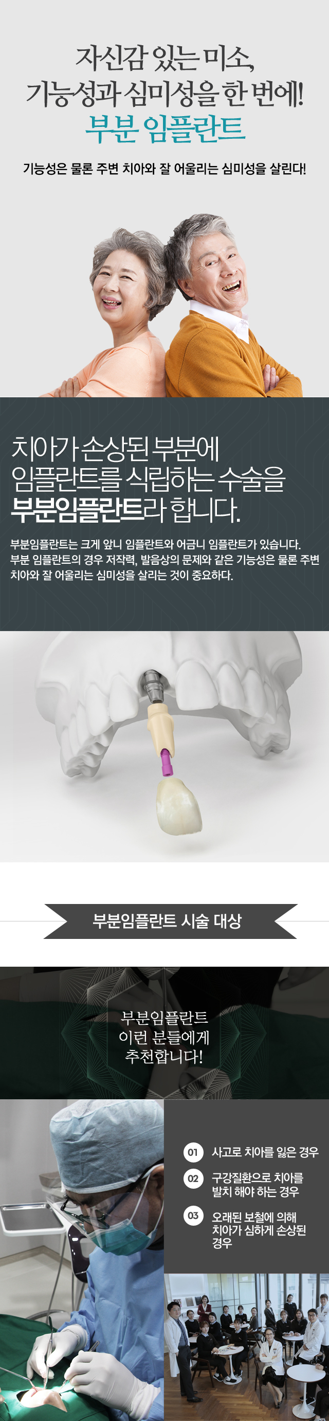 부분임플란트